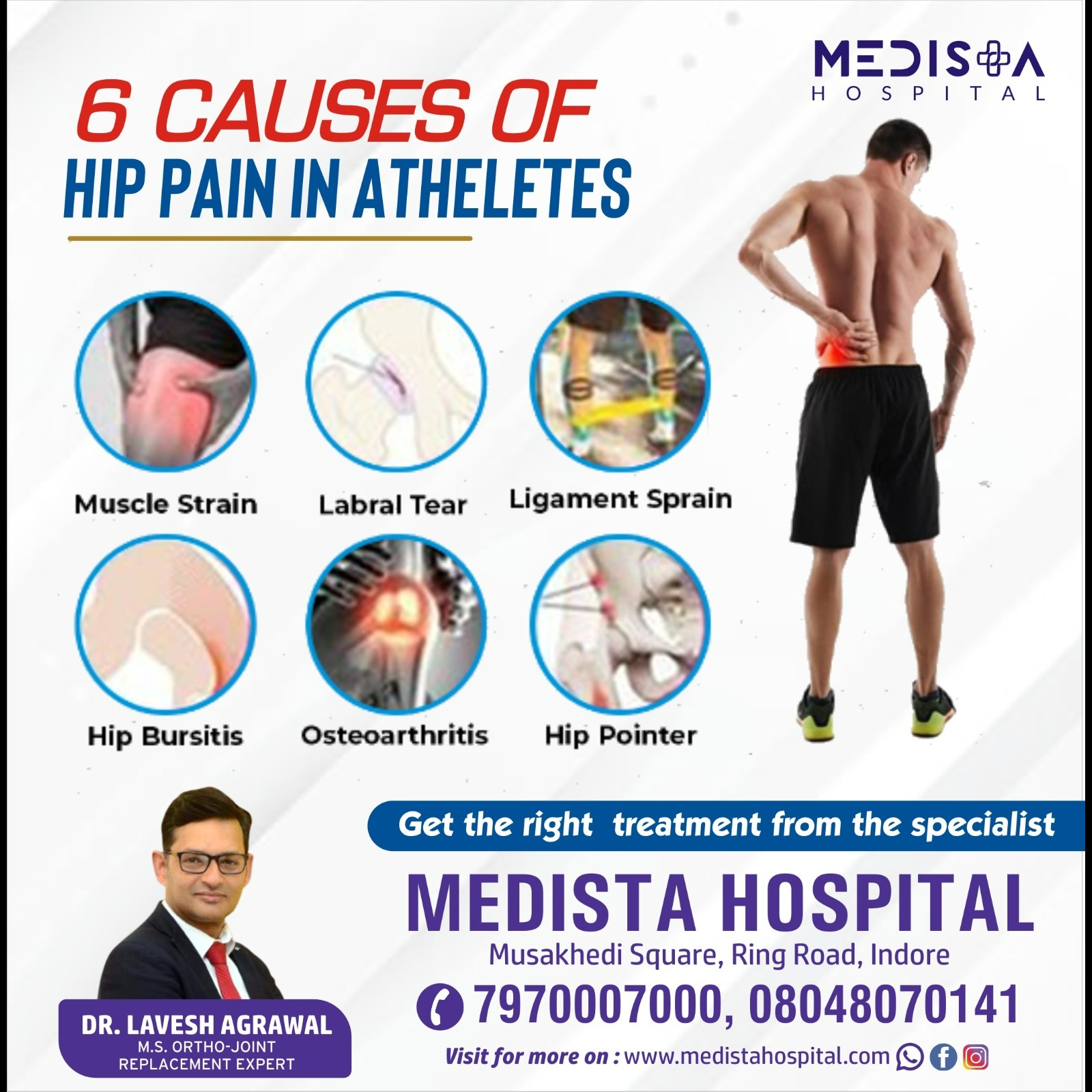 Best Doctor for Hip Pain in Athletes in Indore!... main image
