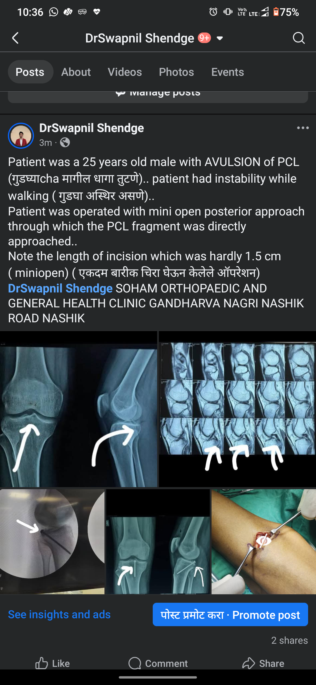 A recent case we operated main image