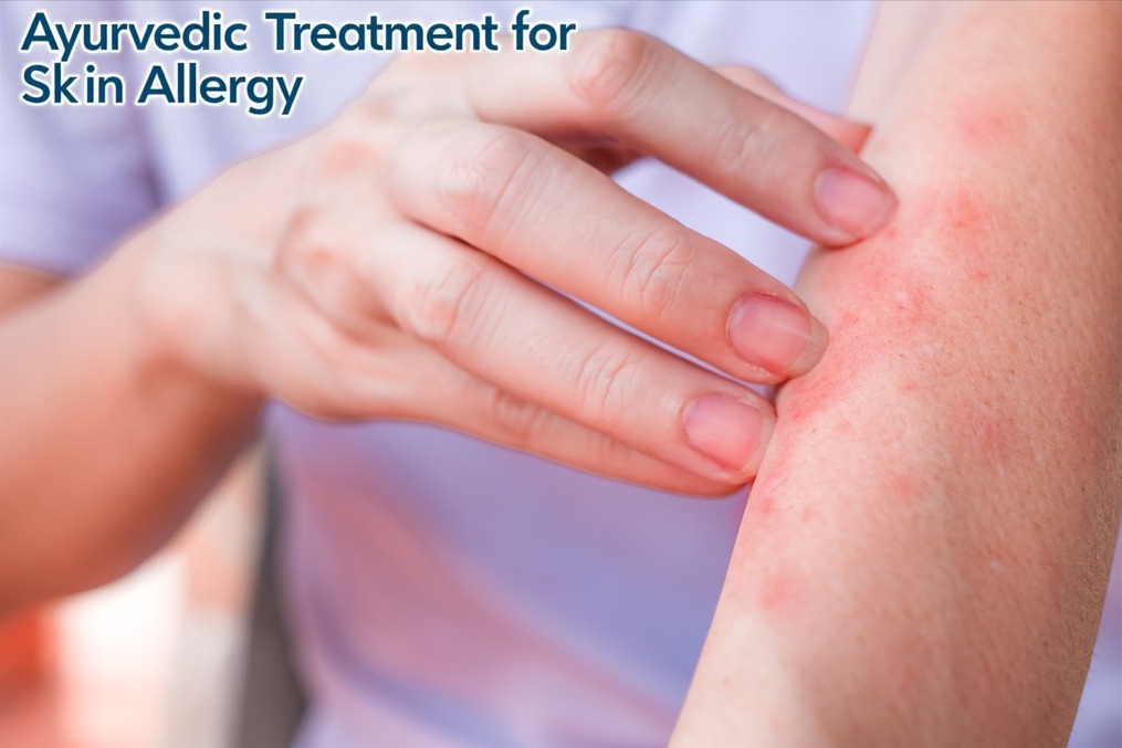 Ayurvedic Treatment for Skin Allergy in Pune – ... main image