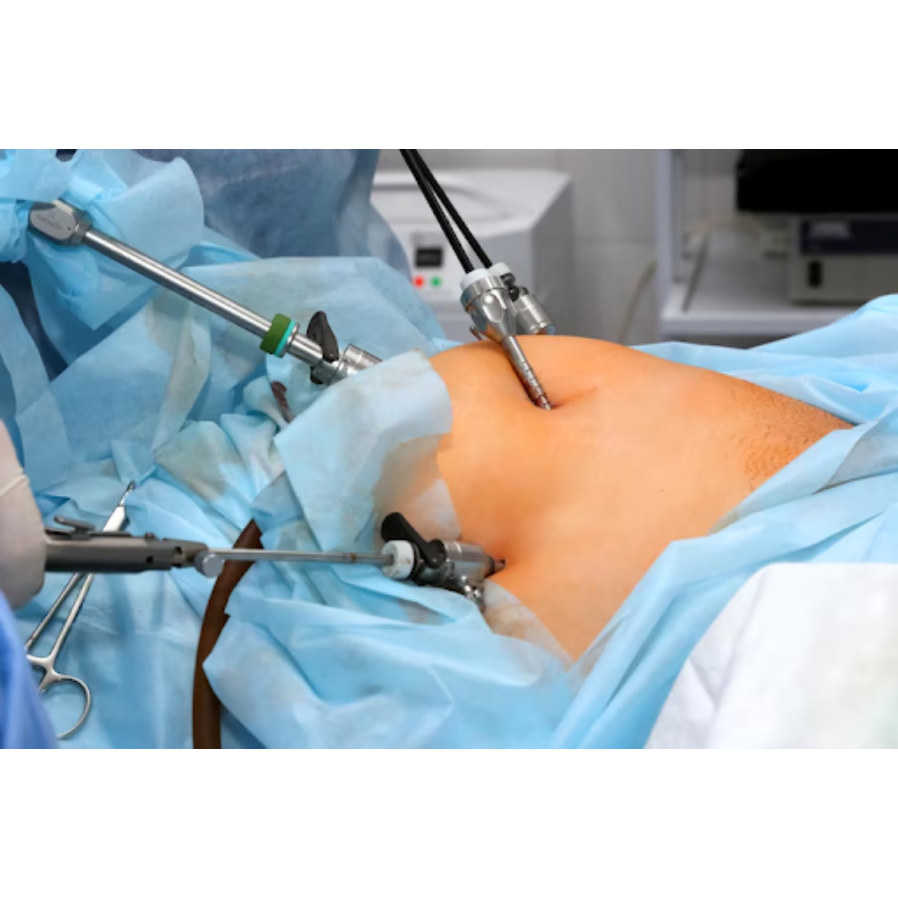 Laparoscopy Specialist in Pune – Minimally Invasiv... main image