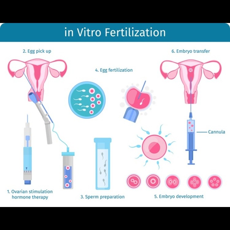 IVF hospital in Sulur Can’t conceive!! Get the Bes... main image
