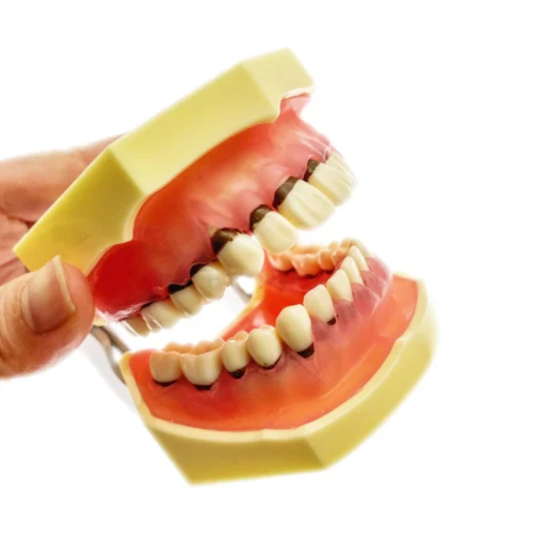 Periodontal Disease Treatment in Moti Nagar – Prot... main image