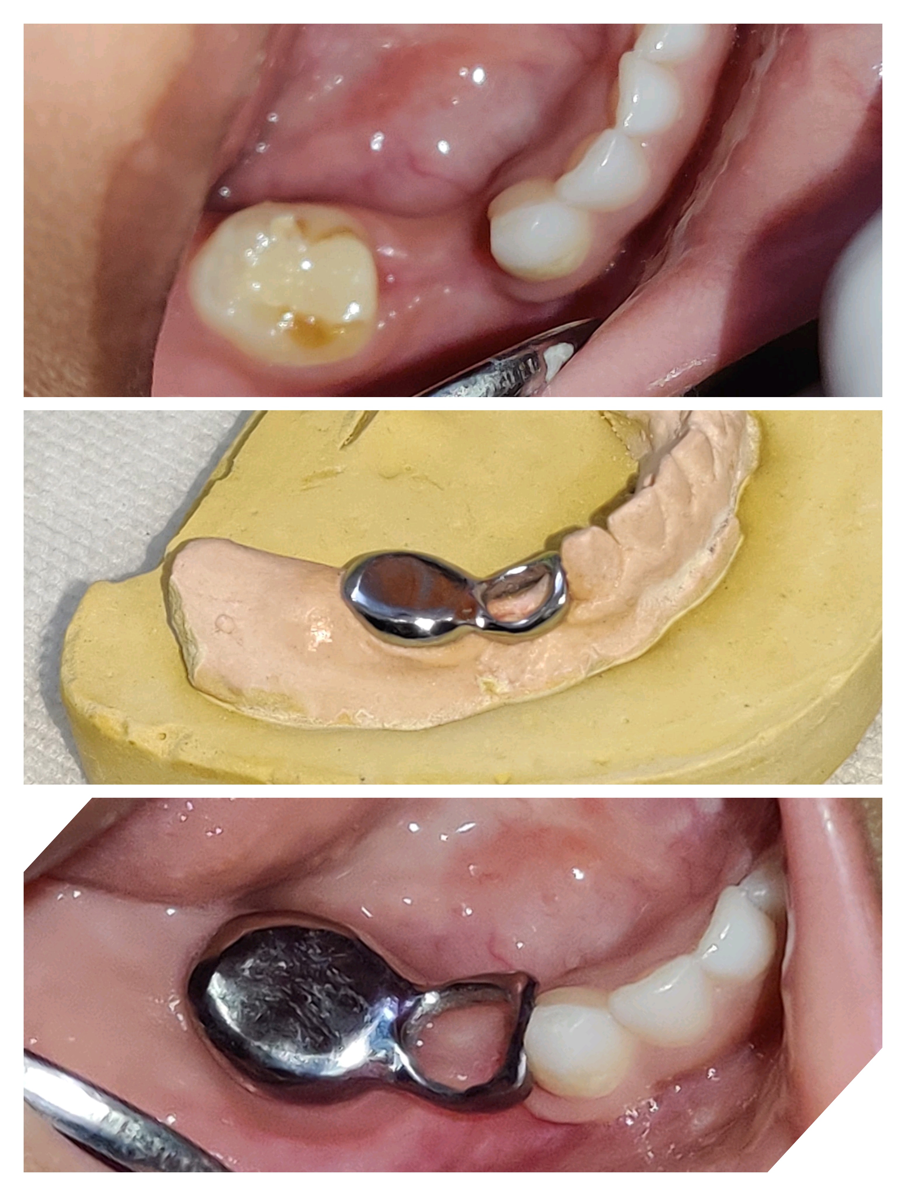 Child dentist near me Kids dentist in Mira Road... main image