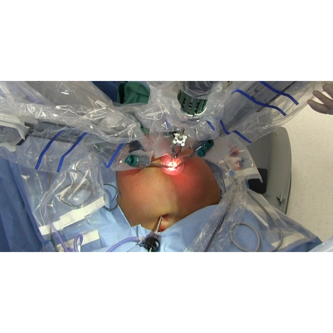 Trusted Robotic Liver Cancer Surgery Specialist... main image