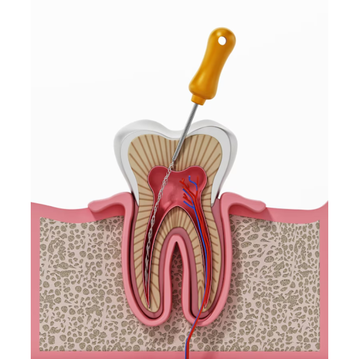 Root Canal Specialist in Nagpur – Precision Car... main image