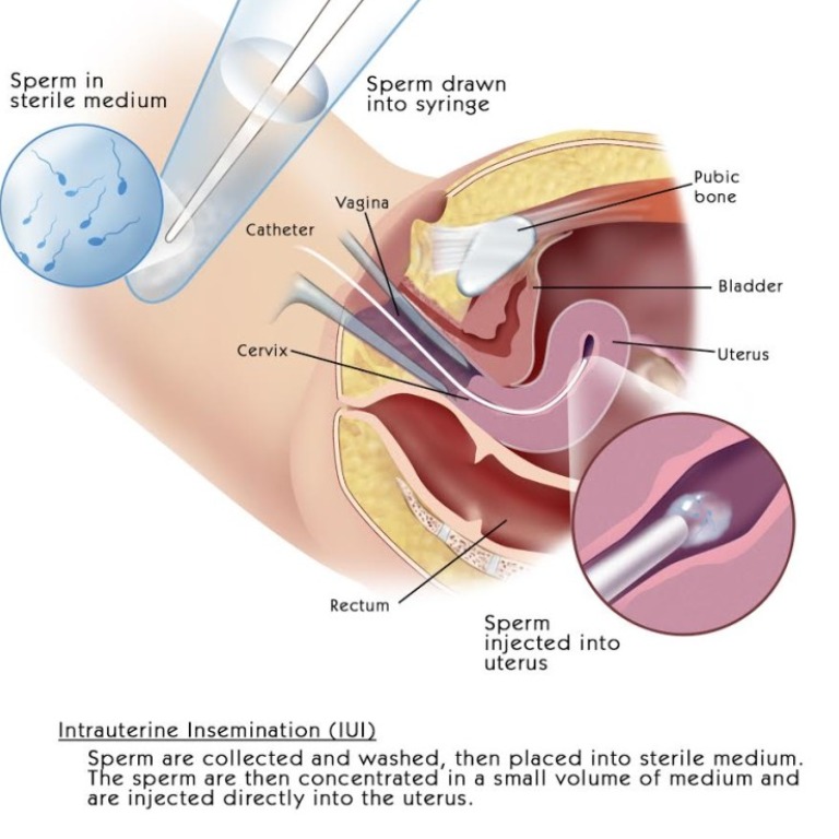 Coimbatore Infertility Treatment Centre IMSI – Ove... main image