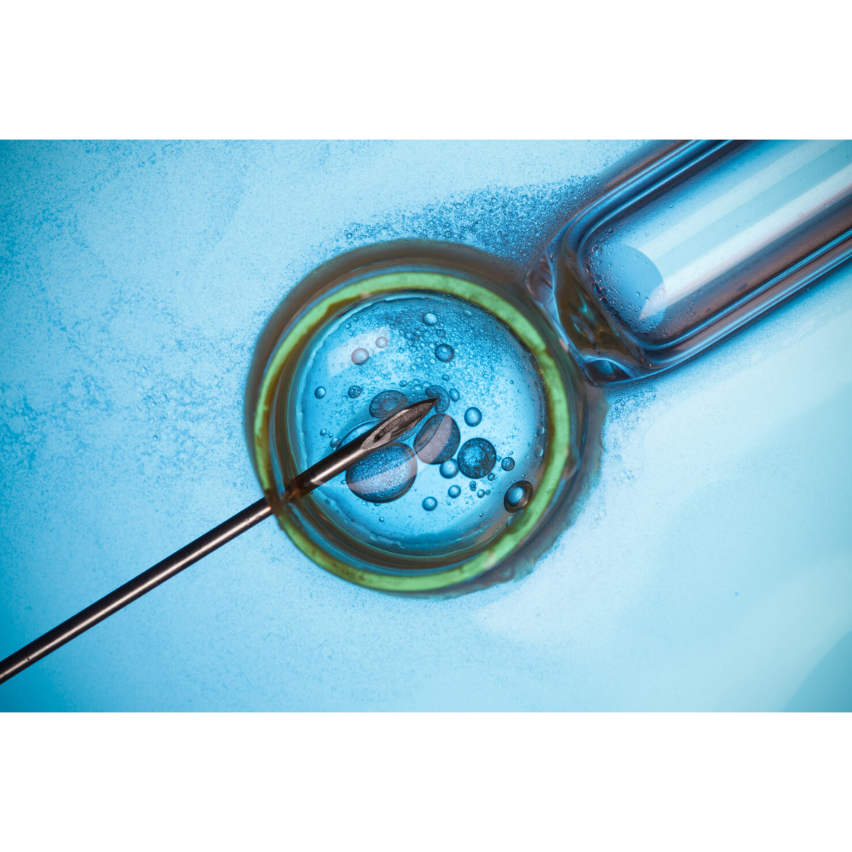 High Success Fertility Clinic for ICSI, IVF in Coi... main image