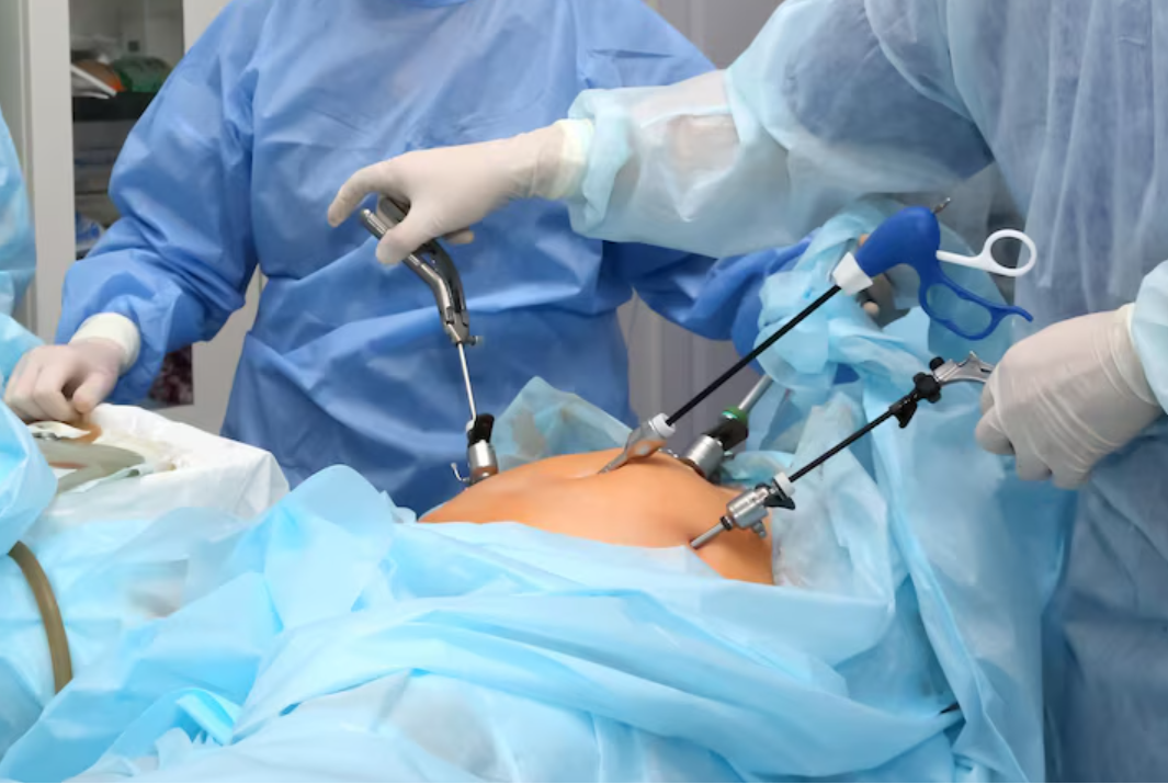 Bariatric Surgery Solutions in Rasta Peth, Pune... main image
