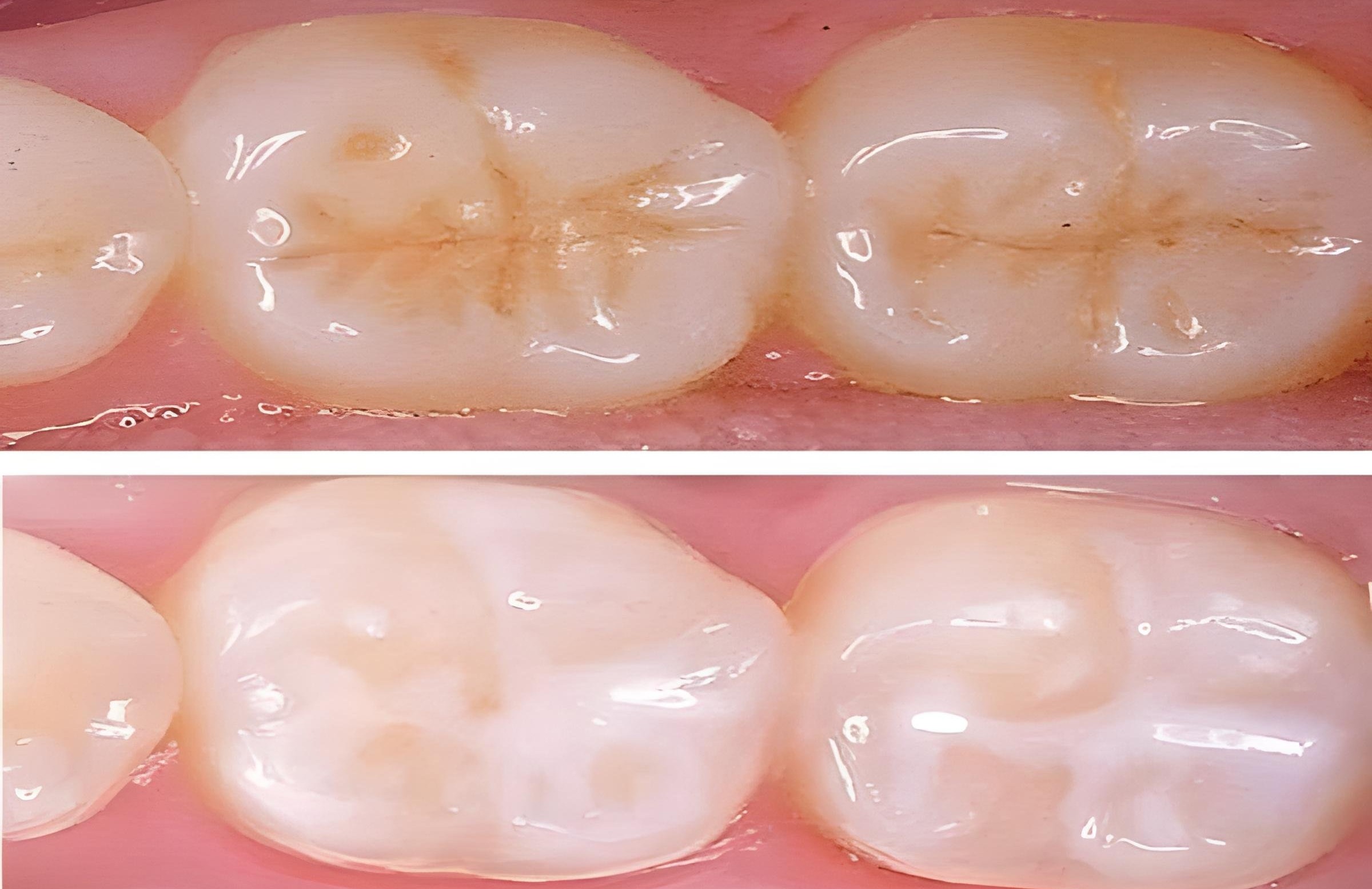 update image
