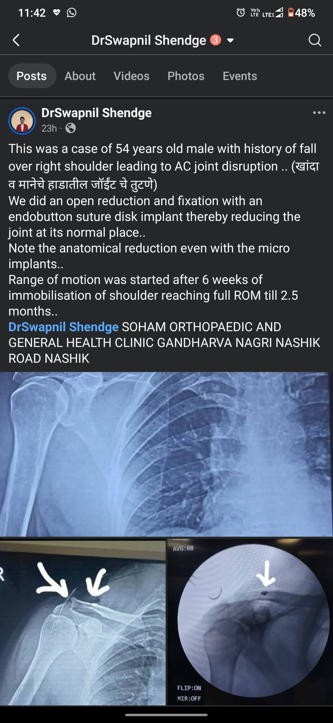 A recent case we operated.. Follow the cases on... main image