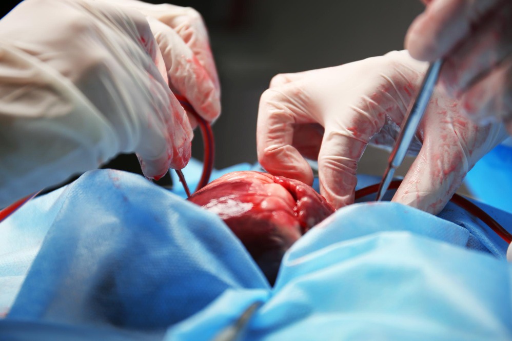 Cardiac Surgery for Children in Nagpur – Specia... main image