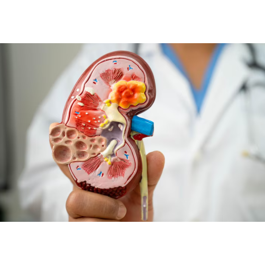 Nephrology in Vashi, Mumbai The kidneys play a cru... main image