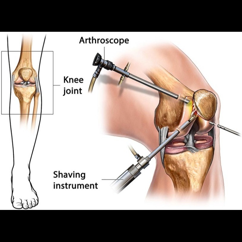 Best Arthroscopy Surgeon in Jaipur Suffering fr... main image