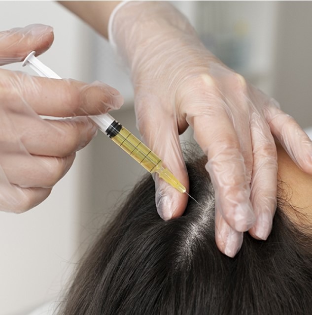 PRP Treatment for Hair Loss: Your Ultimate Guid... main image