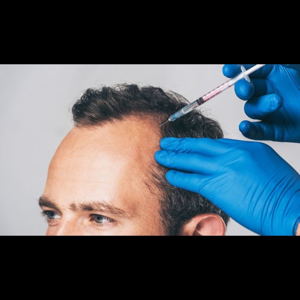 How much does PRP treatment for hair loss cost?... main image