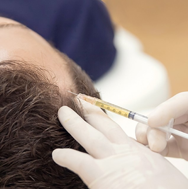 What type of PRP will be used for my hair loss ... main image