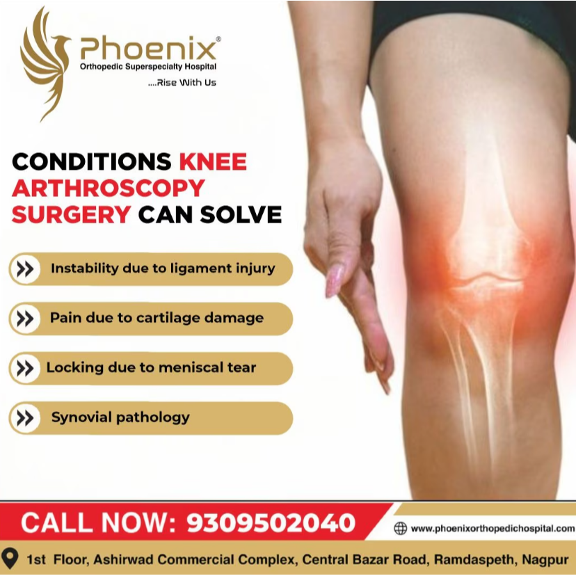 Treatment of Joint Pain and Arthritis in Nagpur... main image