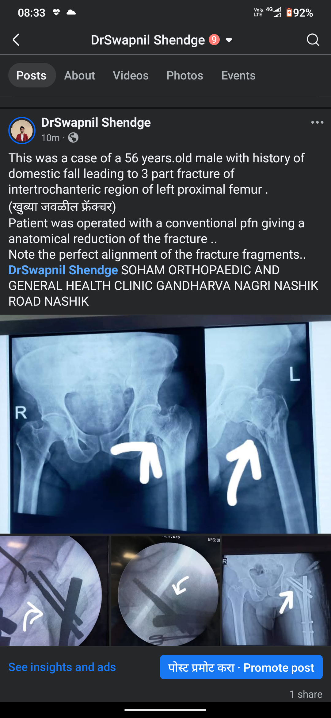 A recent case we operated.. in cases of serious... main image