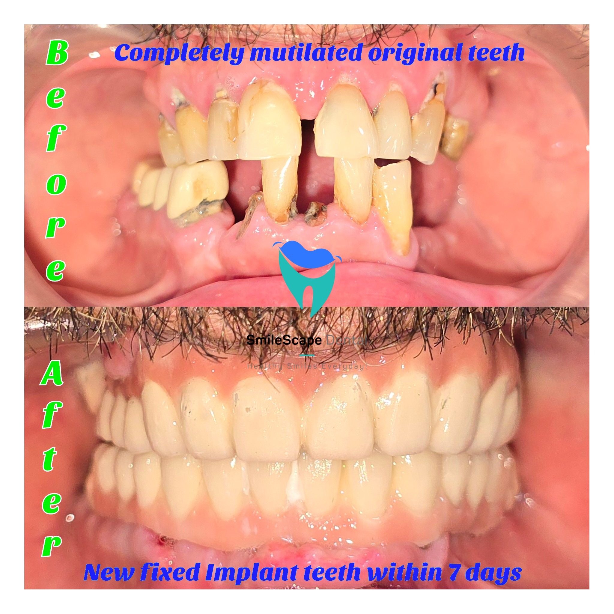 Missing teeth, decayed teeth and infected teeth... main image