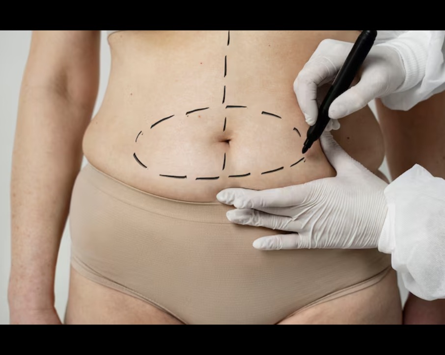 Liposuction in Chennai For those seeking a more sc... main image