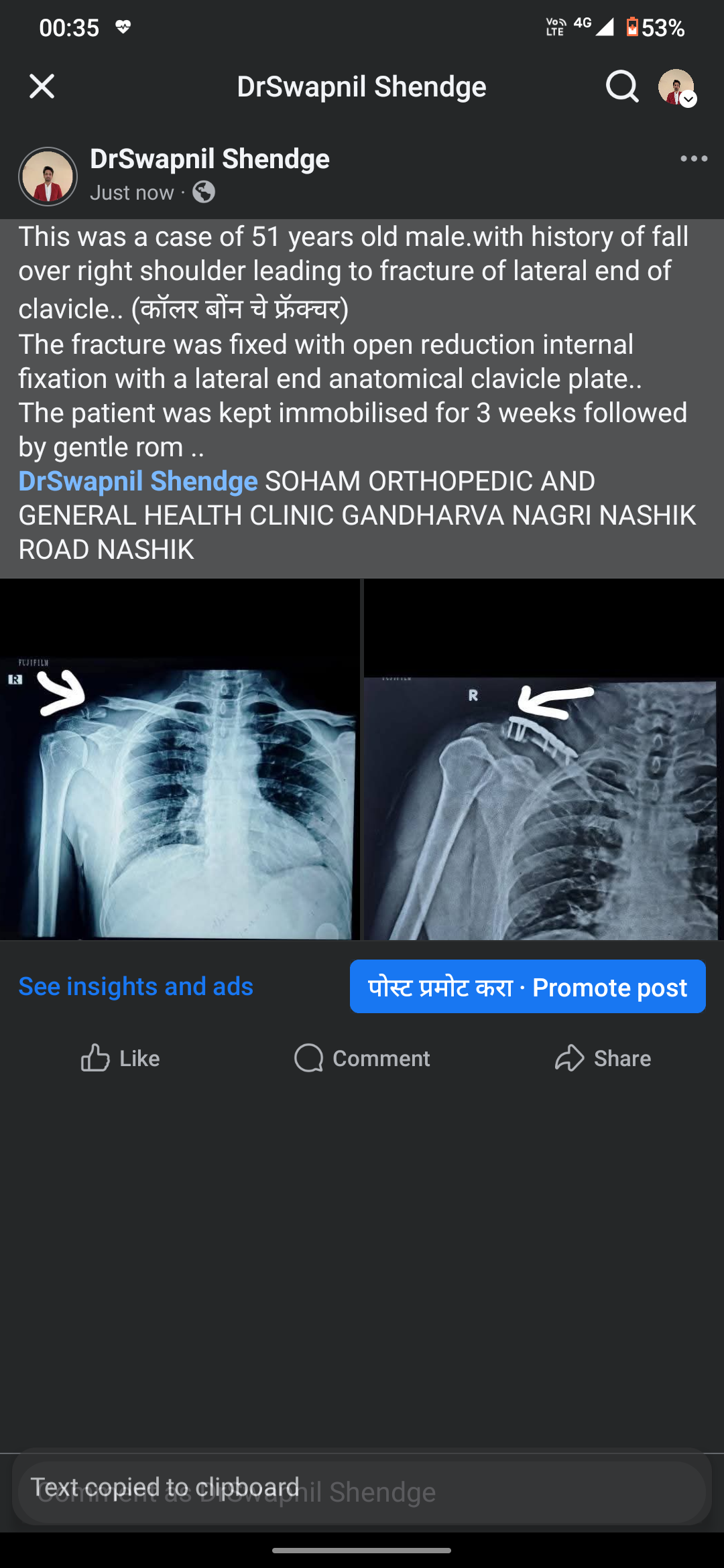 A case we operated recently.. main image
