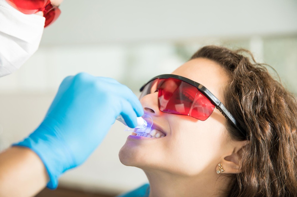 Smile Designing Treatment in Nagpur – Create th... main image