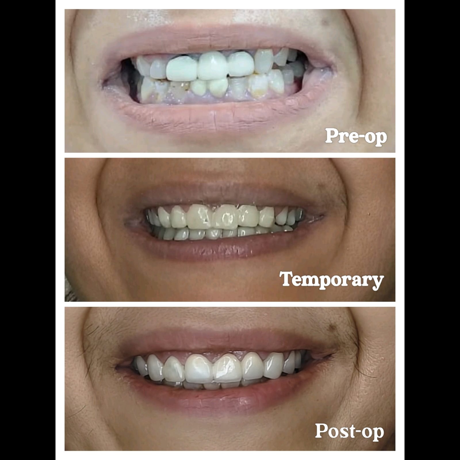 update image