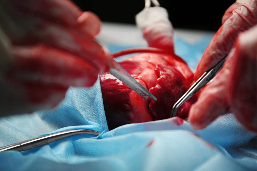 Pediatric Cardiac Surgery in Nagpur – Trusted Surg... main image