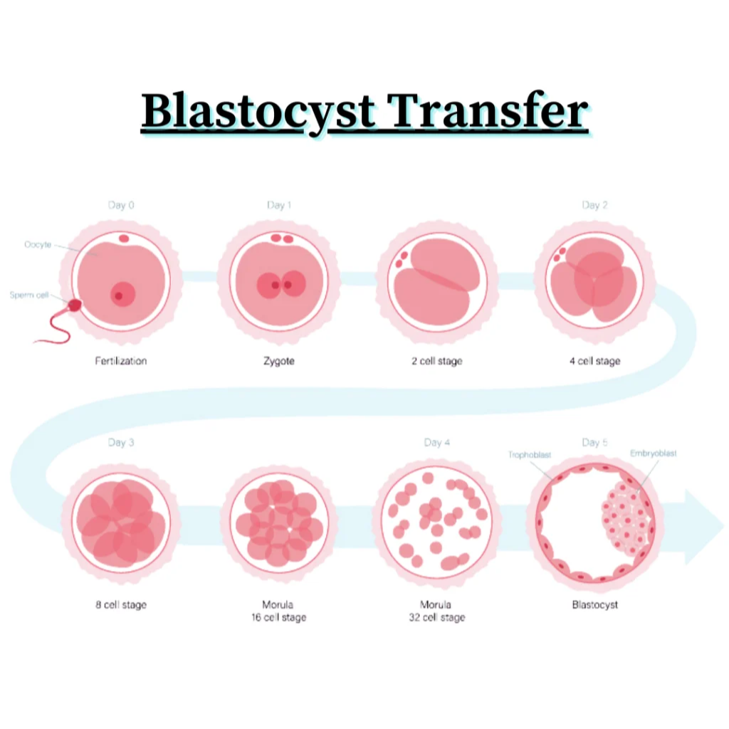 Fertility hospital RS Puram Coimbatore What Is Bla... main image