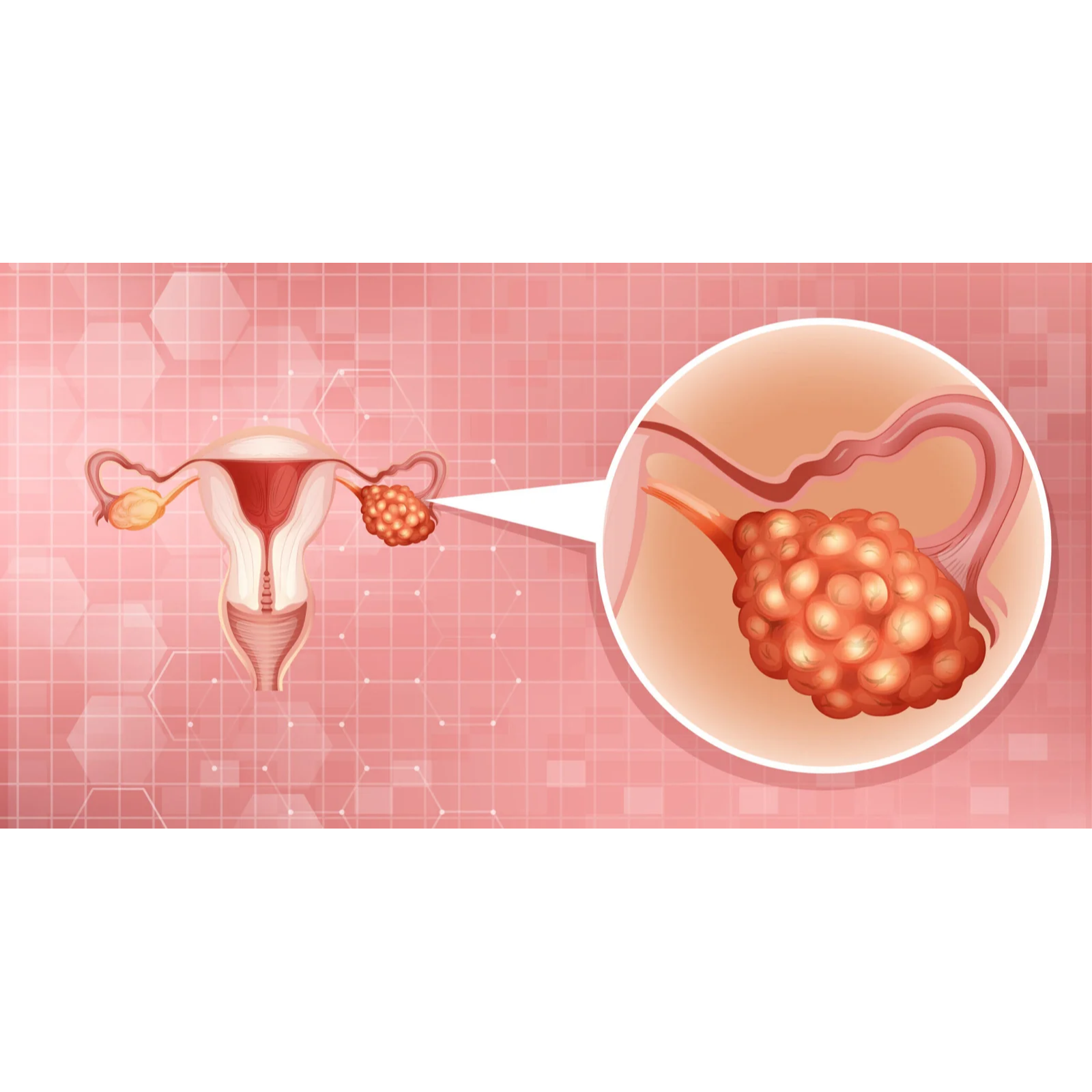 IUI Clinics Coimbatore Laser-Assisted In IVF, 'las... main image