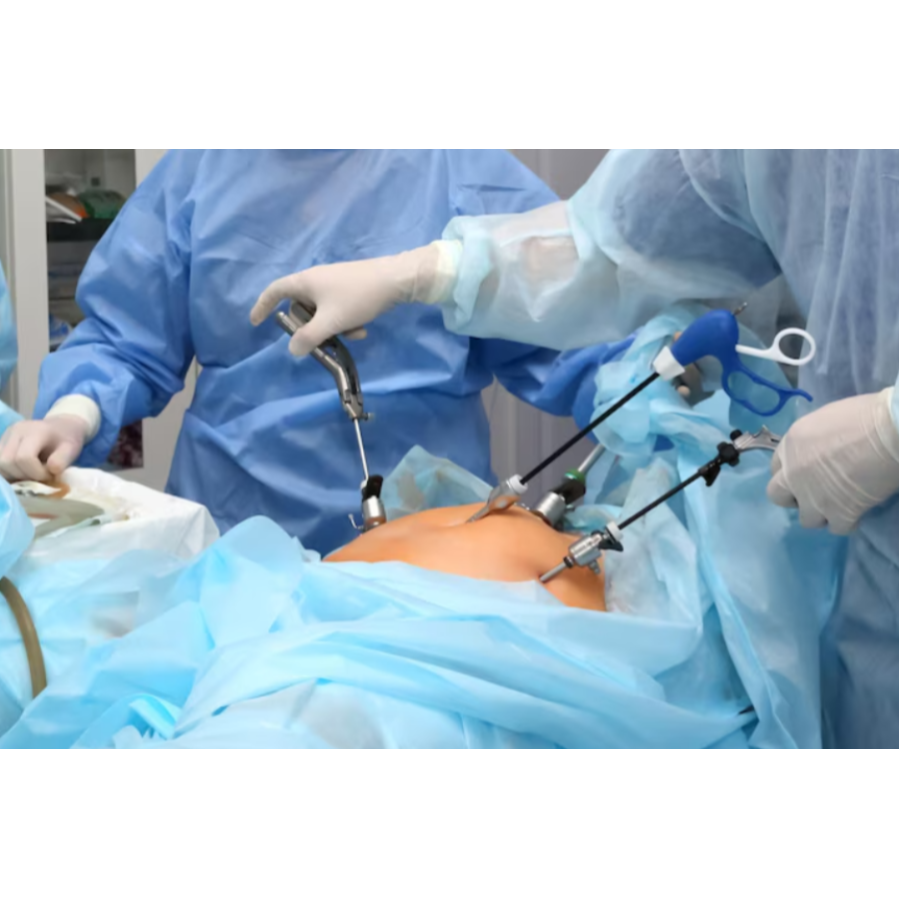 Laparoscopic Surgery Near Peenya – Faster Recov... main image