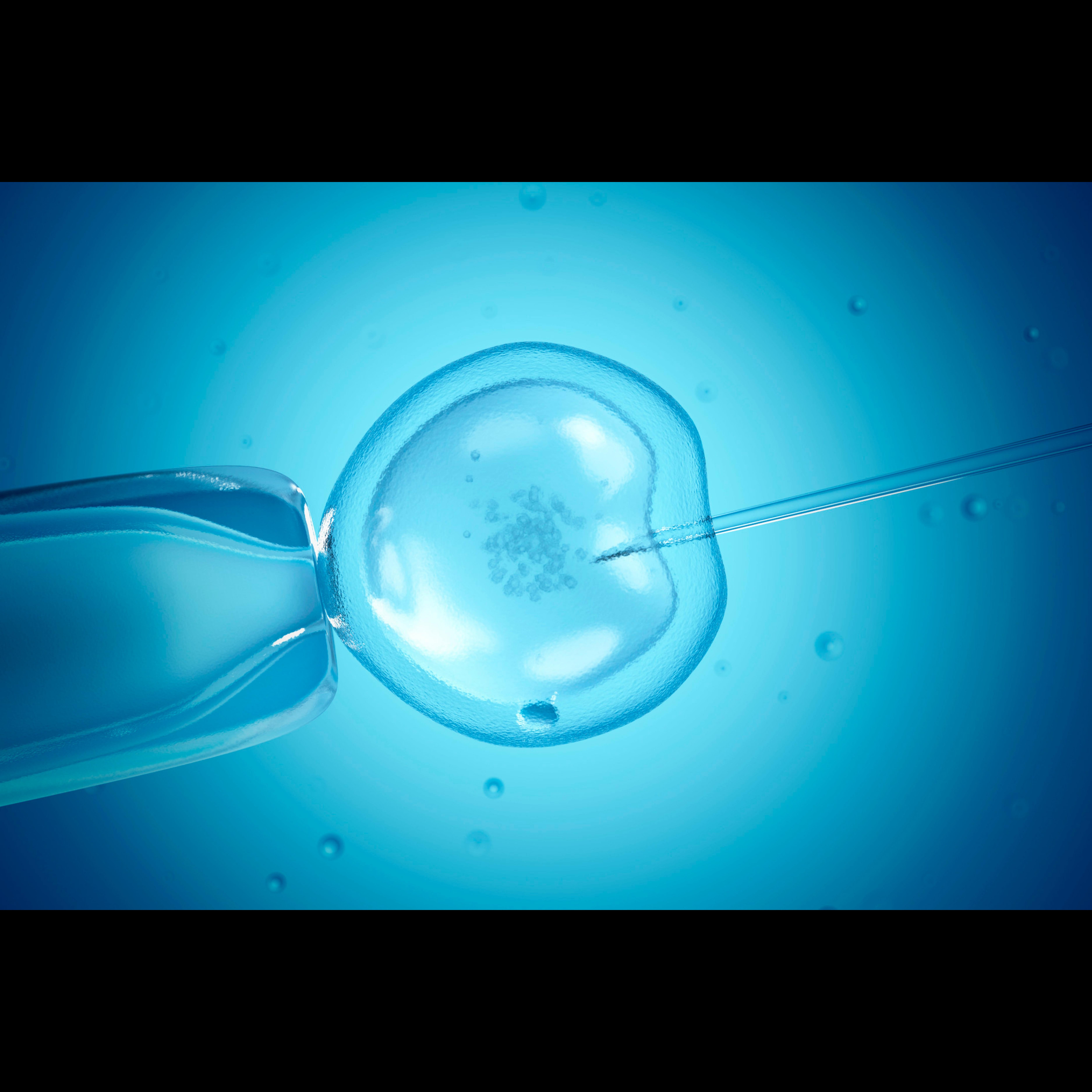 IVF Treatment Centre in Chennai – Advanced Fert... main image
