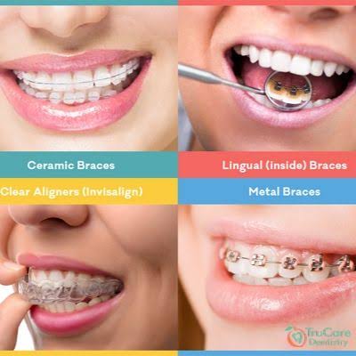 Our team at Paras Dental Care Implant and Ortho... main image