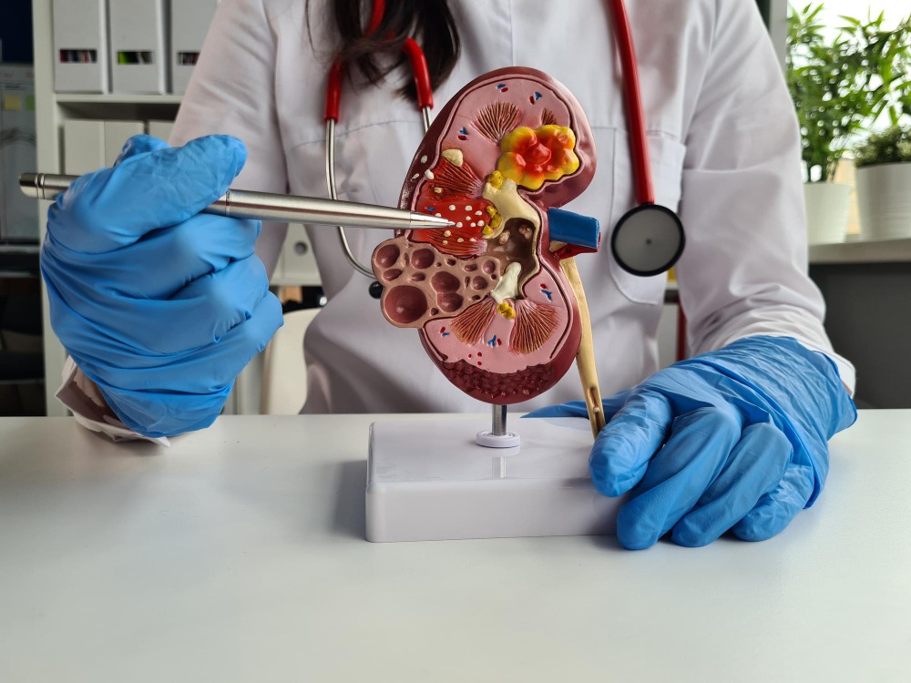 Laser Surgery Treatment for Kidney Stone in Dom... main image