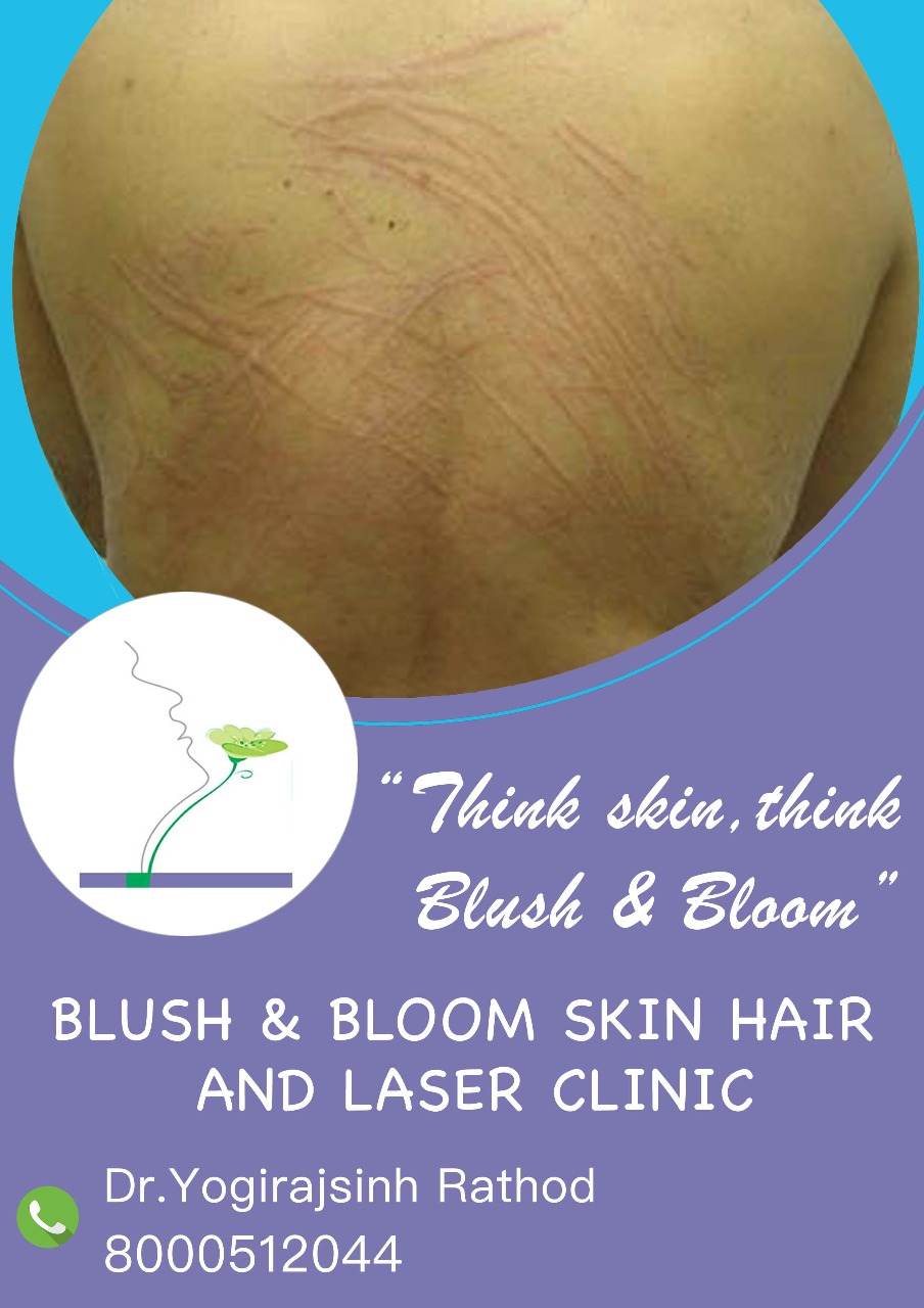Urticarea??? Think skin, think Blush & Bloom!!!... main image