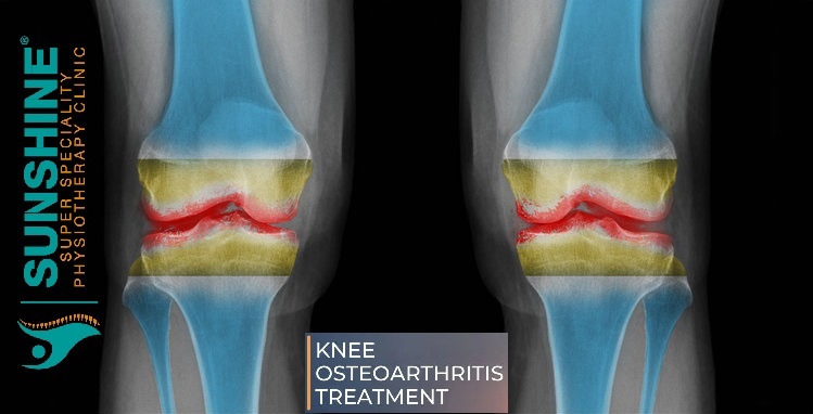 Physiotherapy clinic in Tambaram Are you Looking f... main image