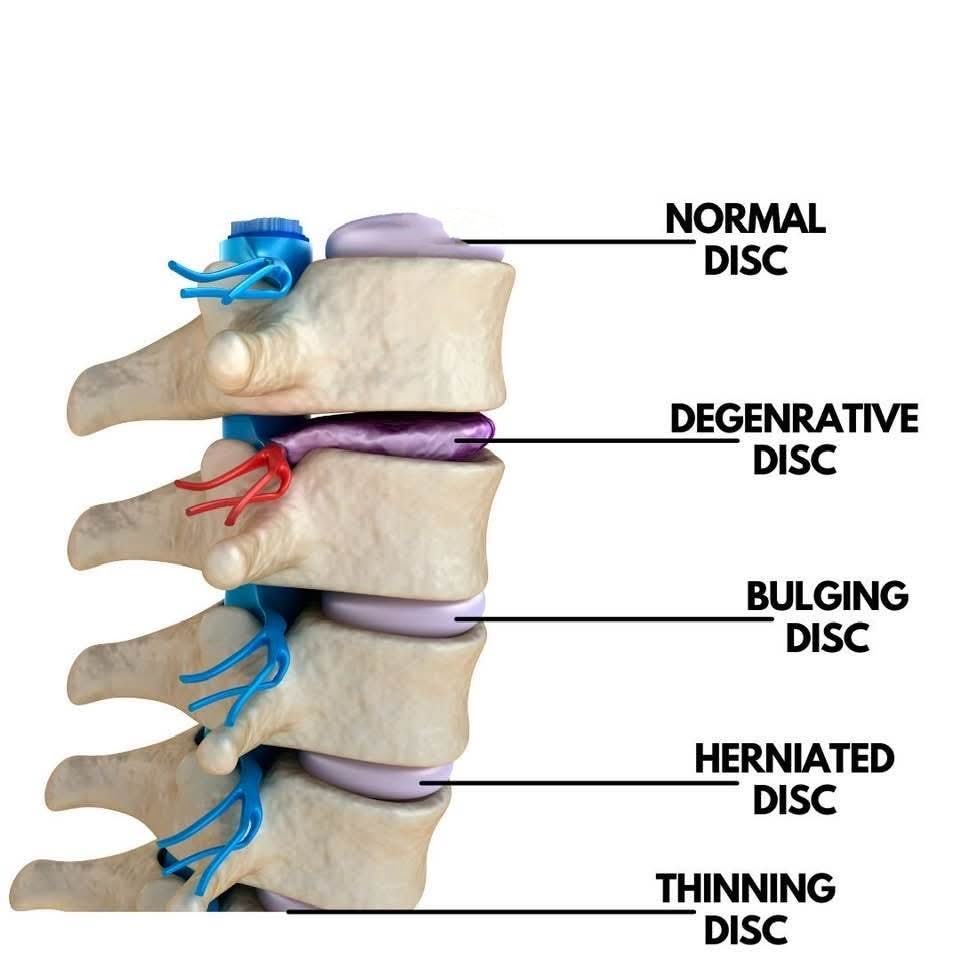 SUNSHINE ® SUPER SPECIALITY PHYSIOTHERAPY CLINIC -... main image