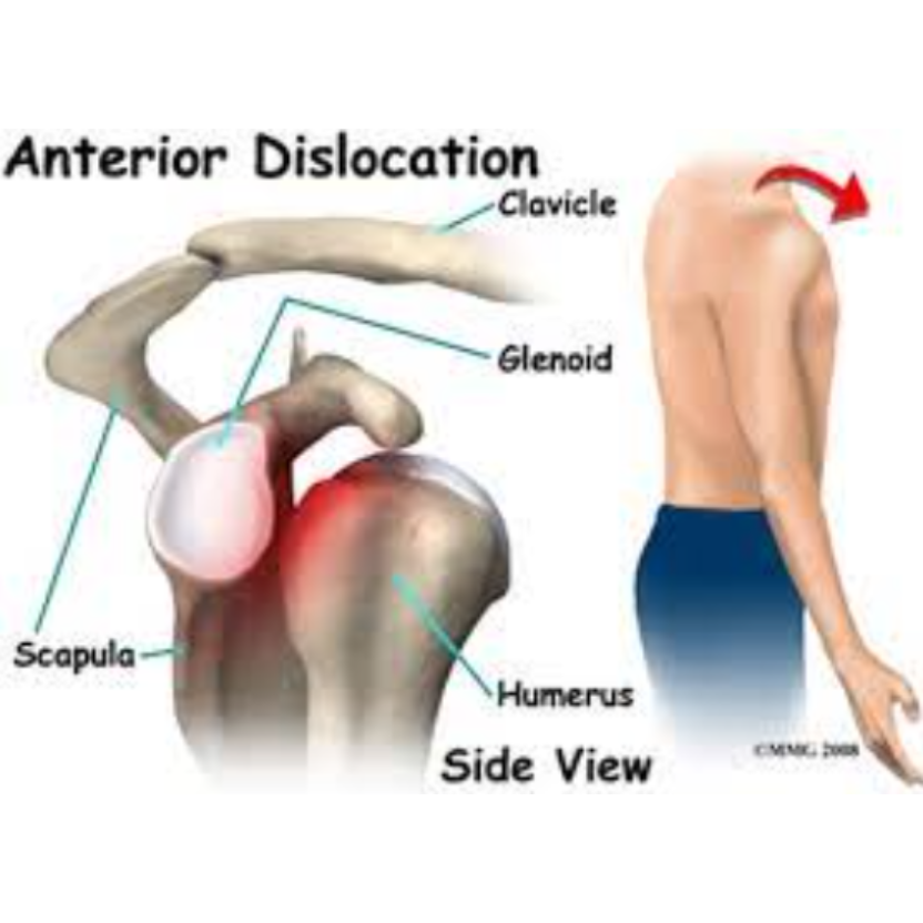 Shoulder Dislocation and Instability Treatment ... main image