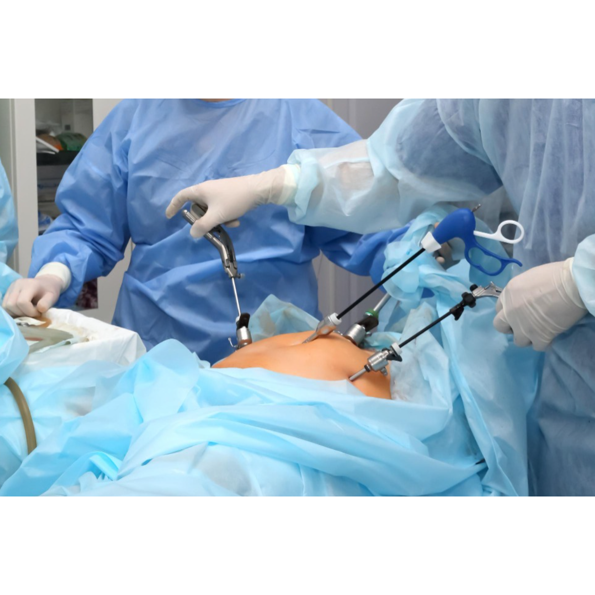 Laparoscopic Surgery Specialist in Pimpri for M... main image