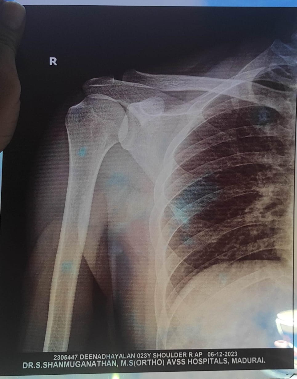 🔸 Shoulder Pain Treatment at Sunshine Clinic – Exp... main image
