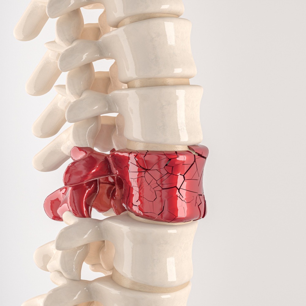 Cervical Disc Replacement Specialist in Nagpur ... main image