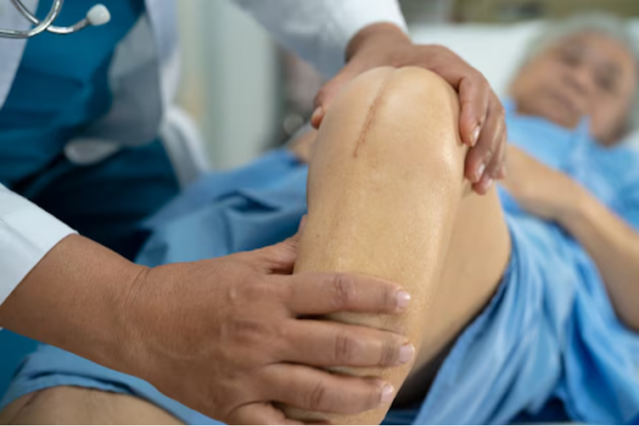 Joint Replacement Surgery in Pune - Restoring P... main image