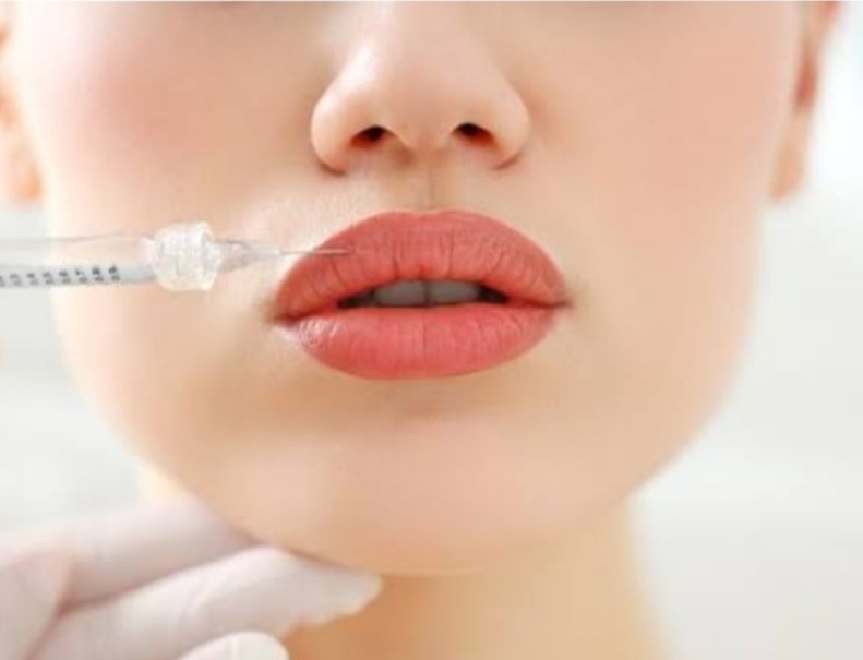 Facial fillers at Doctor’s Hub Sinhagad Road – ... main image