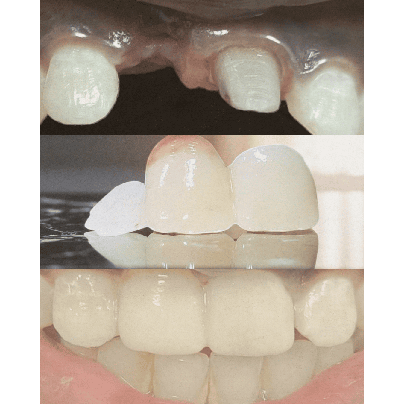 update image