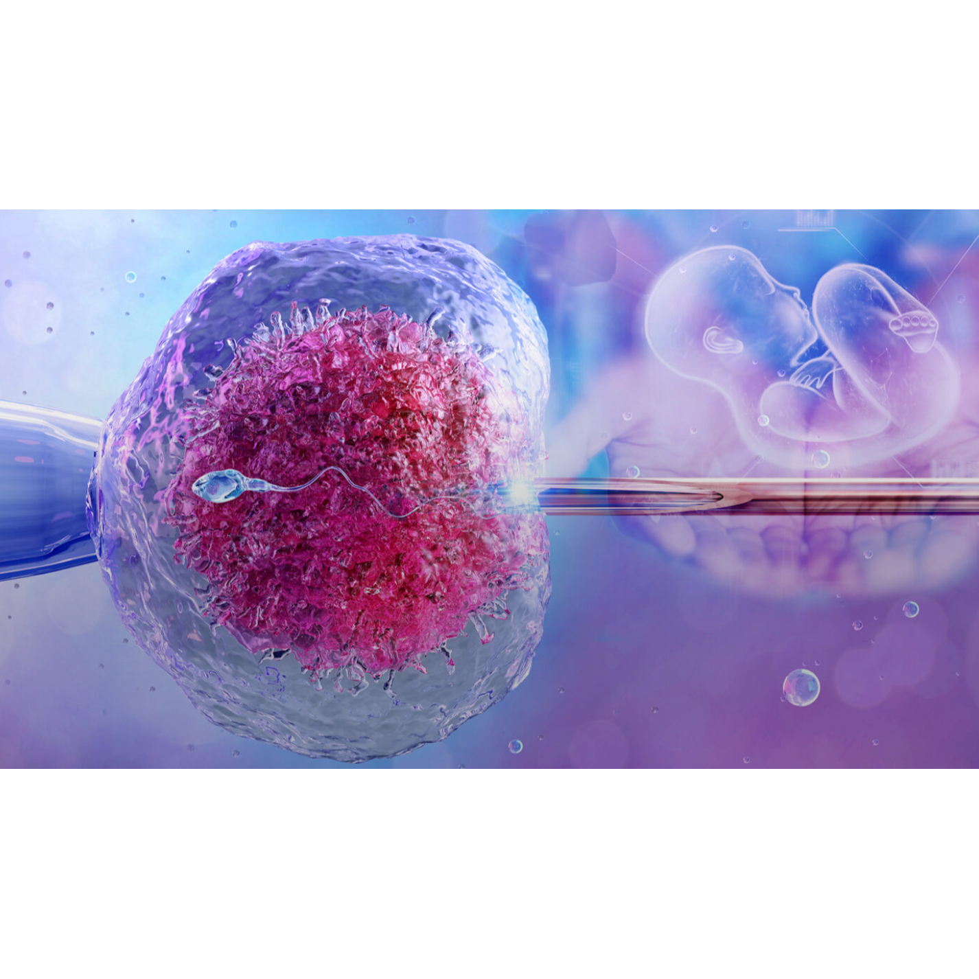 IVF and IUI Clinic in Coimbatore – Complete Fertility C... main image
