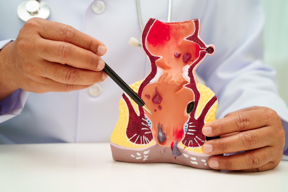 Proctologist In Velachery – Get The Right Diagnosis And TreatmentFacing recurring pain, itching, or ... main image