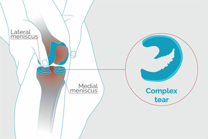 Physiotherapy clinic in Tambaram Are you Looking f... main image