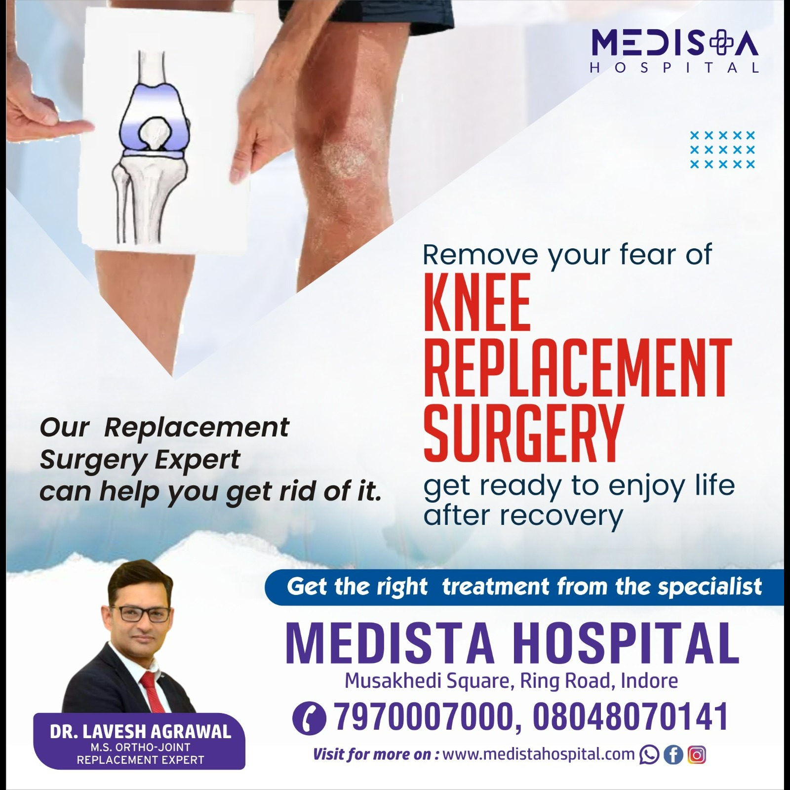 Best Joint Replacement Surgery in Indore main image
