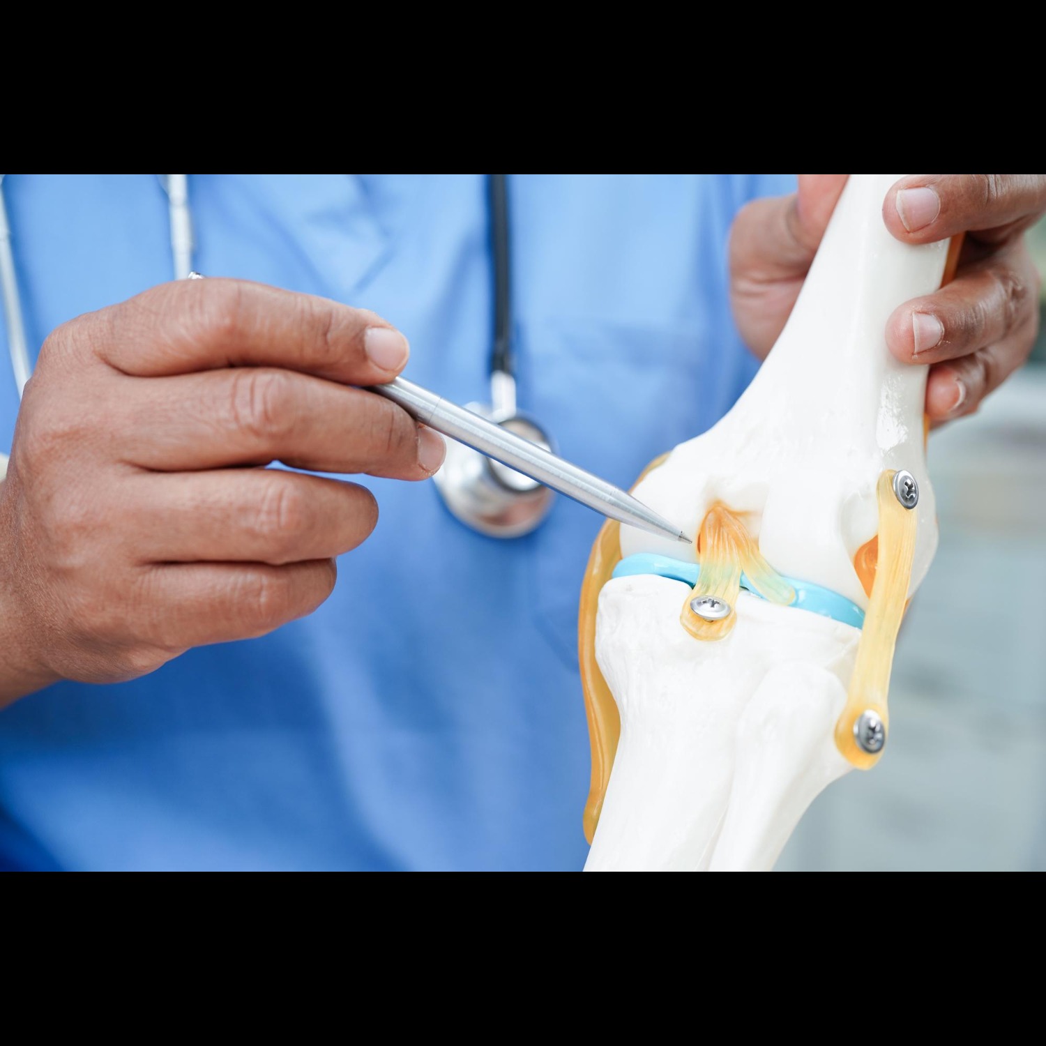 ACL Tear Treatment in New Delhi: Get Back to Motion Without De... main image