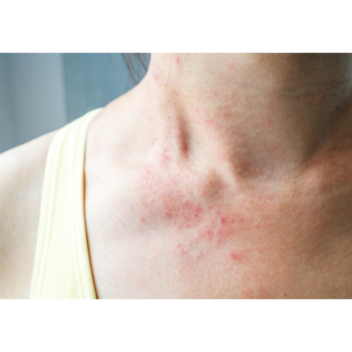 Ayurvedic Skin Treatment in Pune – A Natural Way to Radiant S... main image